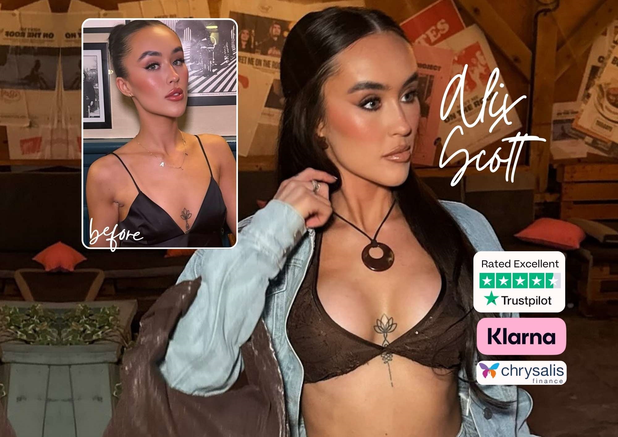 Alix Scott before and after breast enlargement Alix Scott before and after breast enlargement